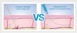 Filler Patients Experience Less Pain, Swelling & Bruising With Use of New Blunt Tipped Micro-Cannulas | Fairfax and Manassas, VA