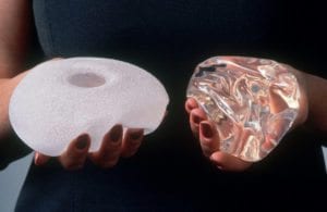 Breast Implants and Cancer