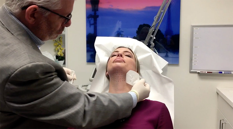 Kybella Video Poster