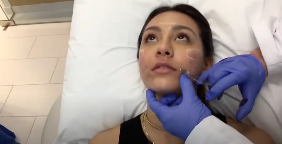 Woman getting a lip injection