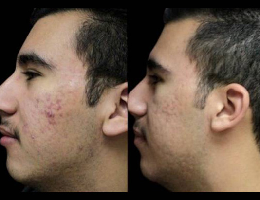 50-year-old-male-skincare-before-and-after-1.jpg