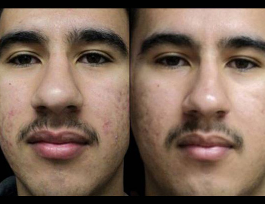 50-year-old-male-skincare-before-and-after.jpg