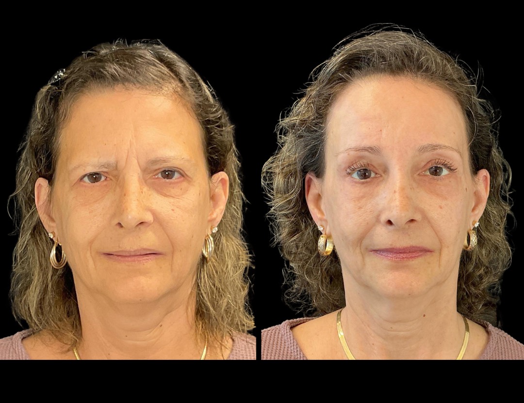 Copy of Copy of Untitled Design – 1