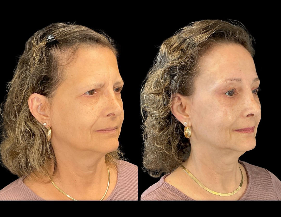 Copy of Copy of Untitled Design – 2