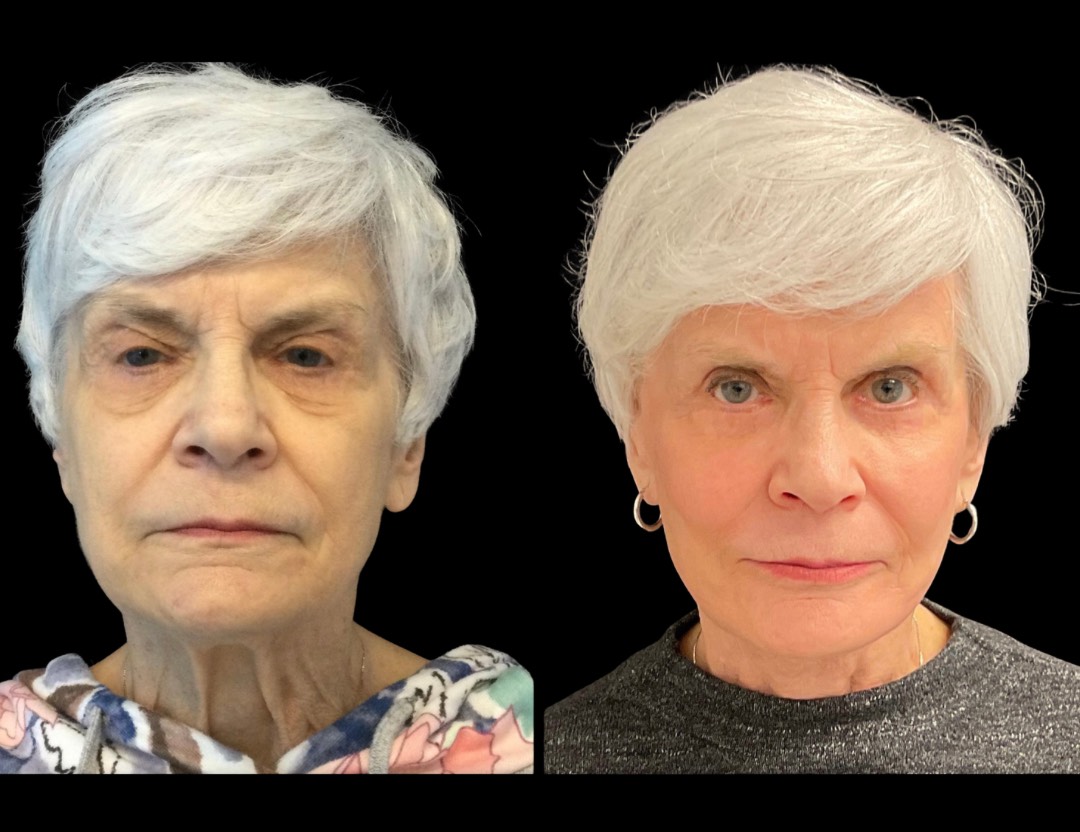 Copy of Untitled Design – 1