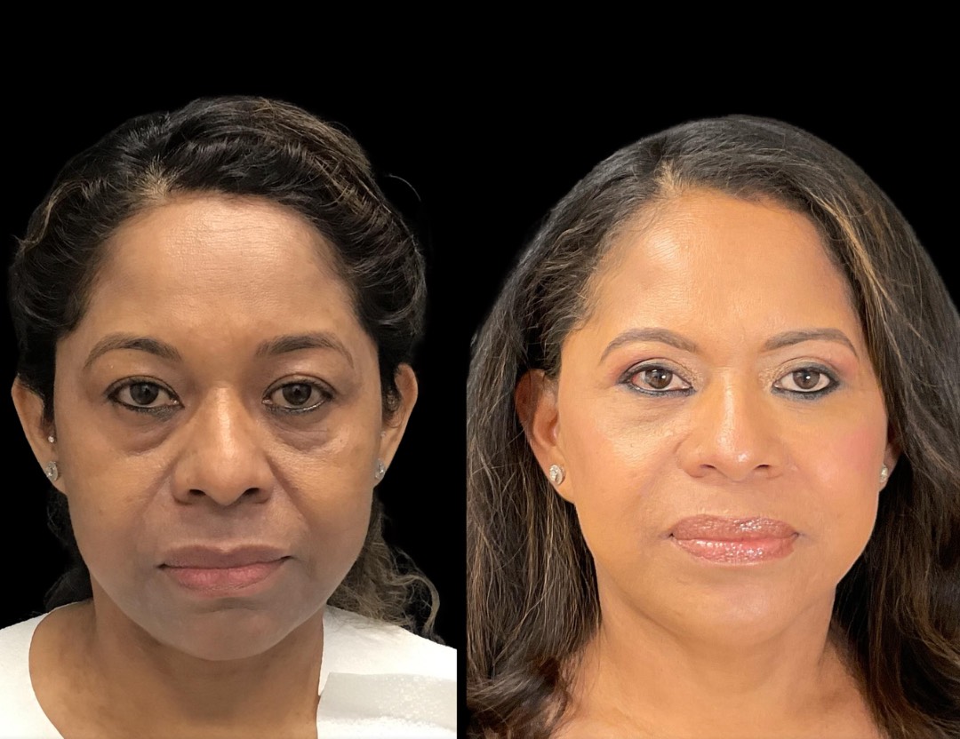 Copy of Untitled Design – 1(1)