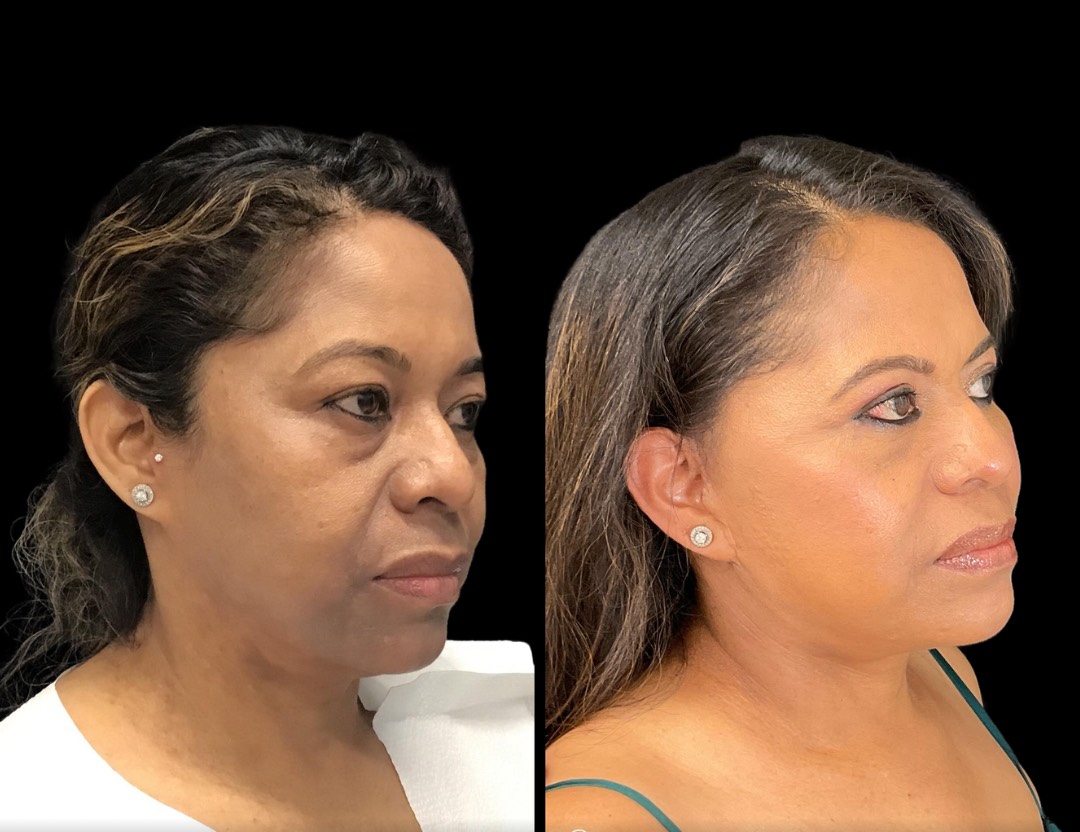 Copy of Untitled Design – 2(1)