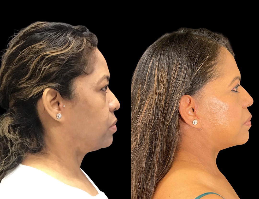 Copy of Untitled Design – 3(1)