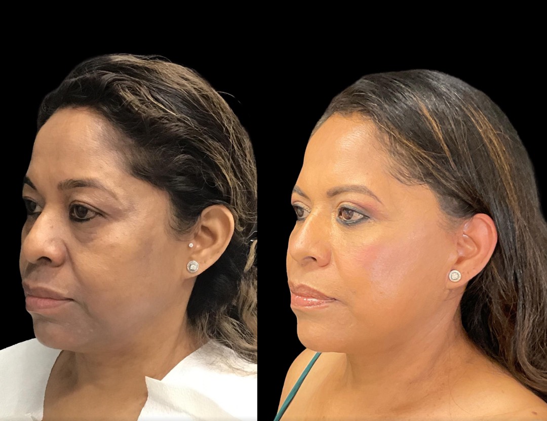 Copy of Untitled Design – 4(1)