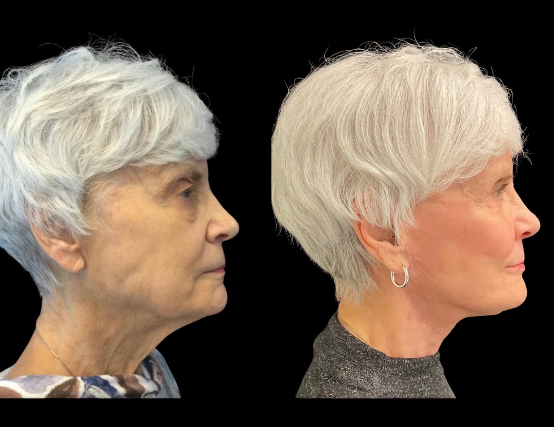 Copy of Untitled Design – 5