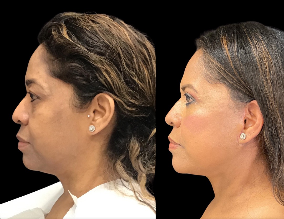 Copy of Untitled Design – 5(1)