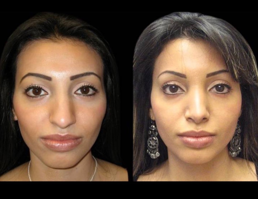 Copy of Untitled Design