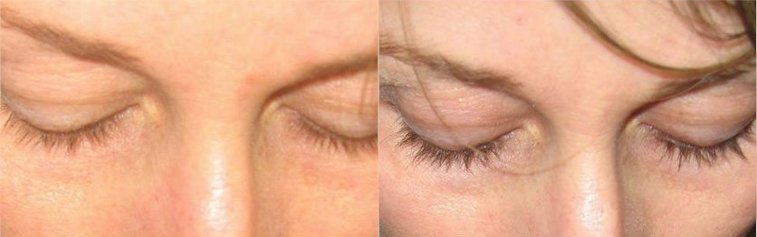 radisse-bitar-cosmedic-institute