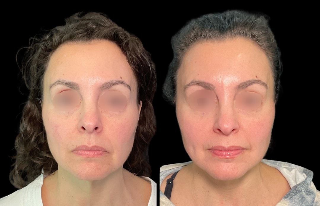 Copy of Untitled Design – 1 (2)