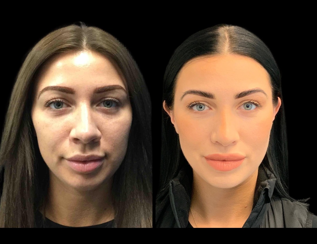 Copy of Untitled Design – 1