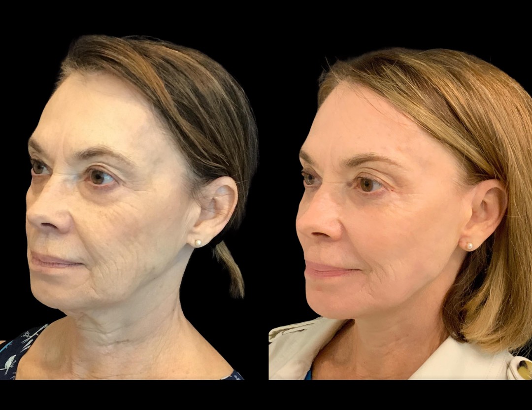 Copy of Untitled Design – 1(2)