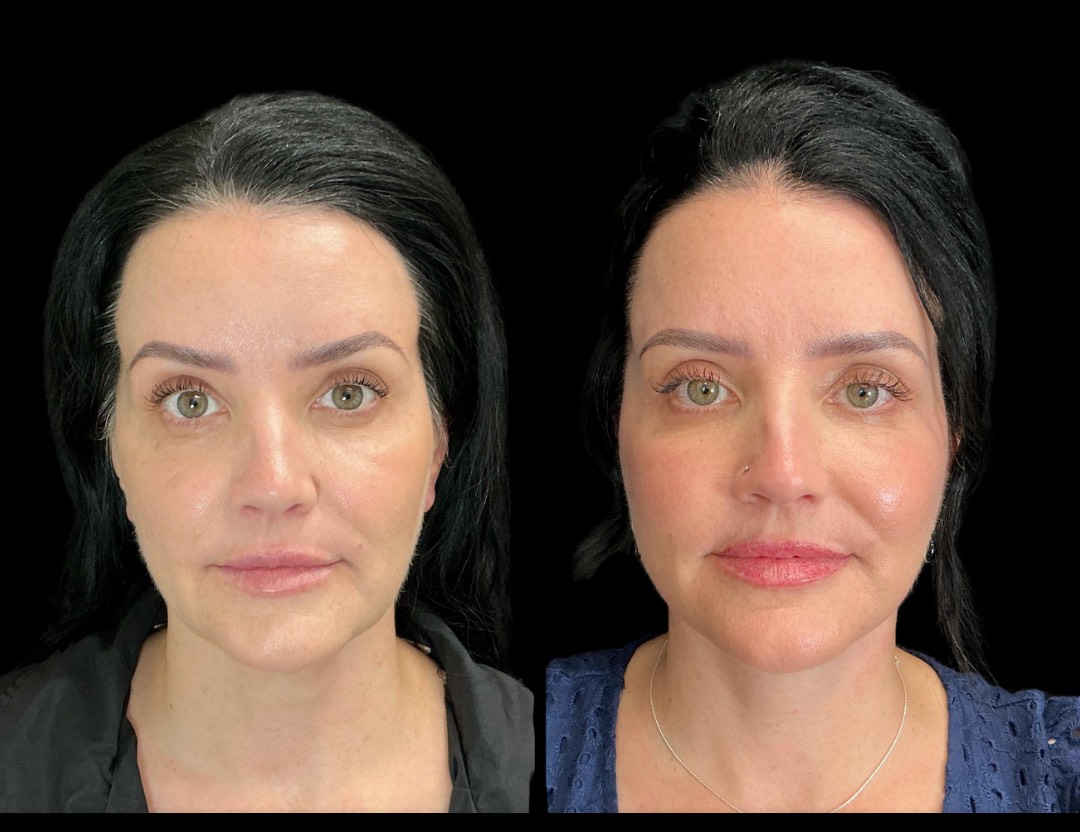 Copy of Untitled Design – 1(3)