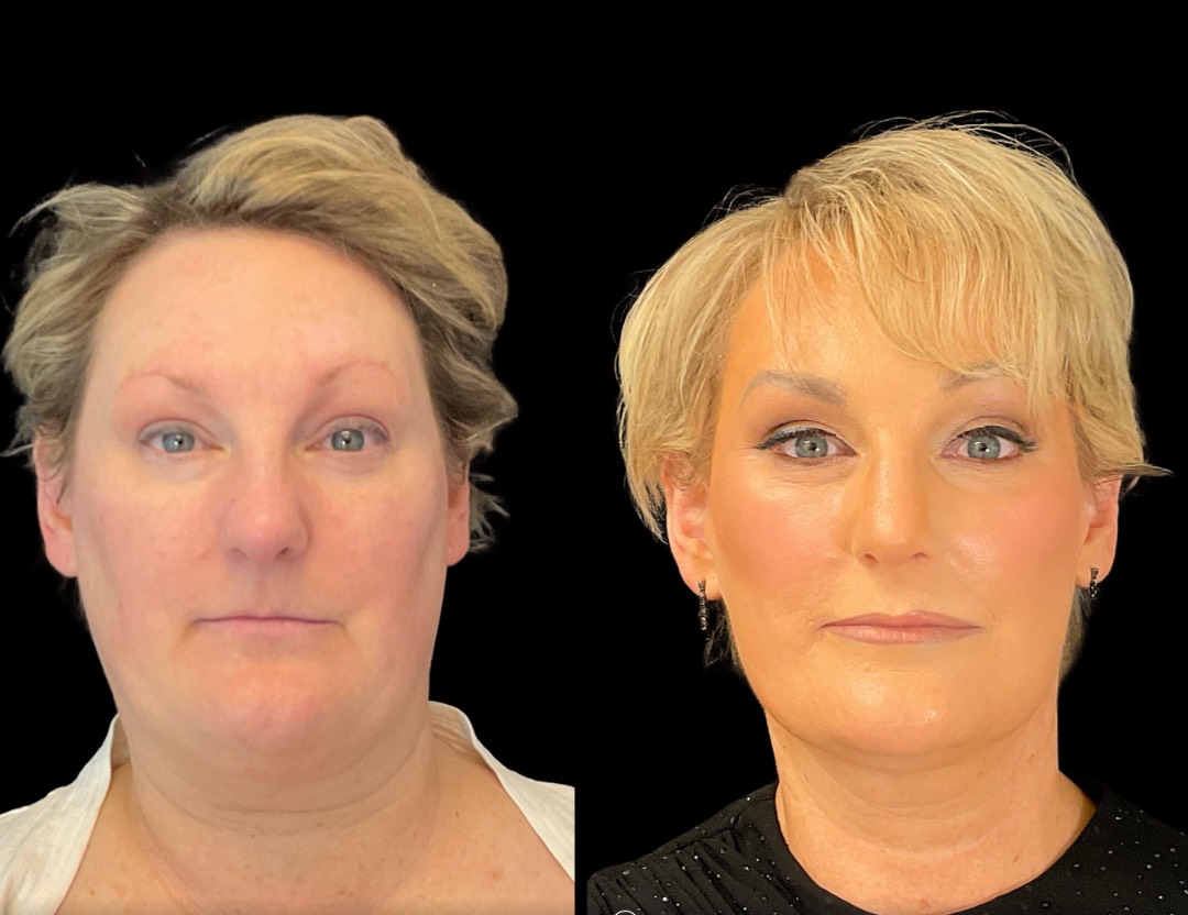 Copy of Untitled Design – 1(4)