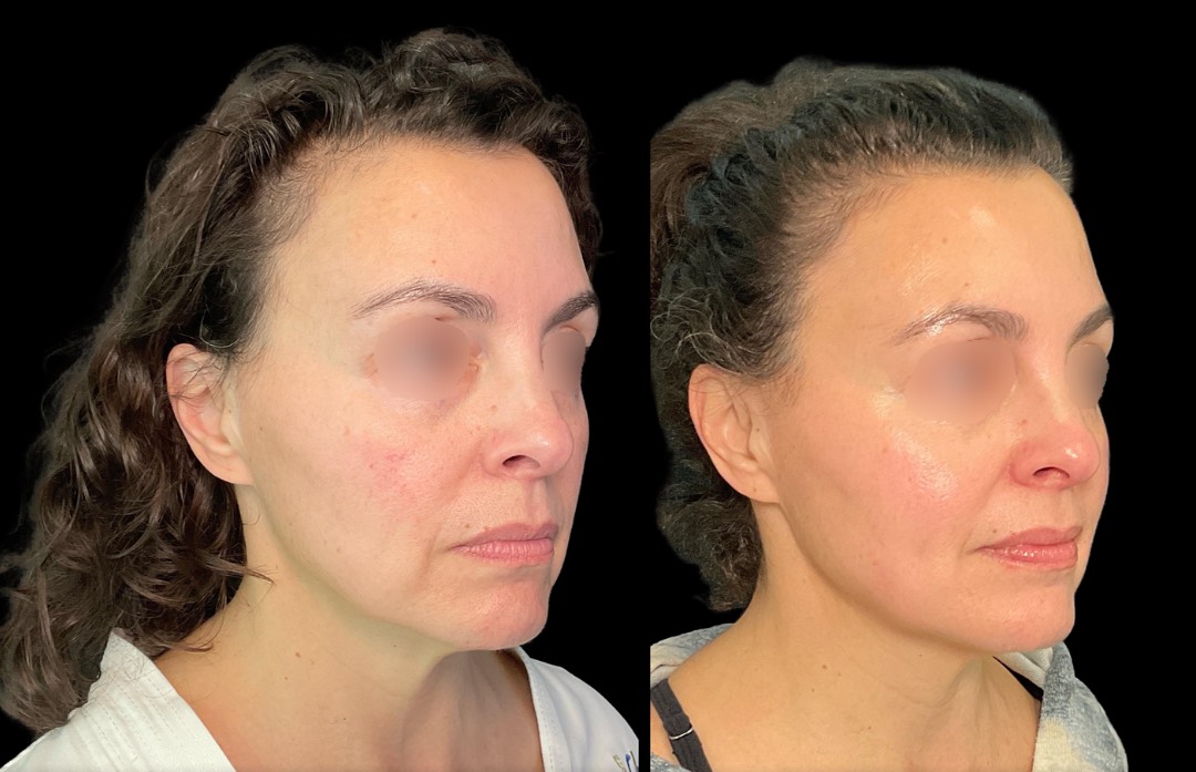 Copy of Untitled Design – 2 (2)