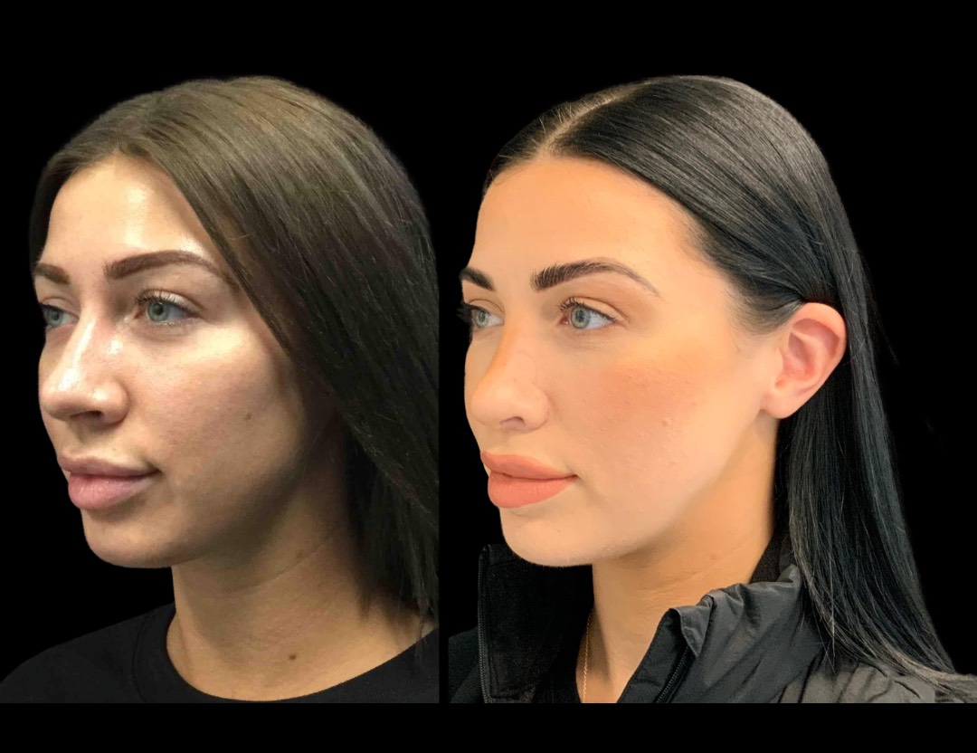 Copy of Untitled Design – 2