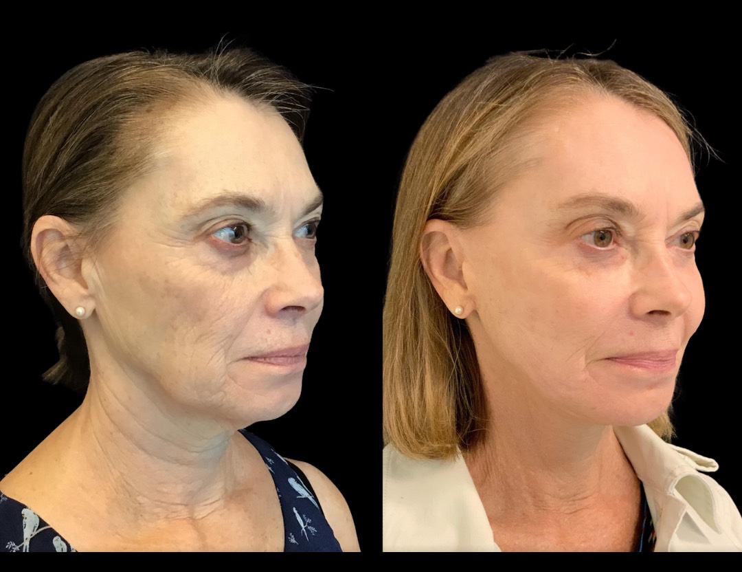 Copy of Untitled Design – 2(2)