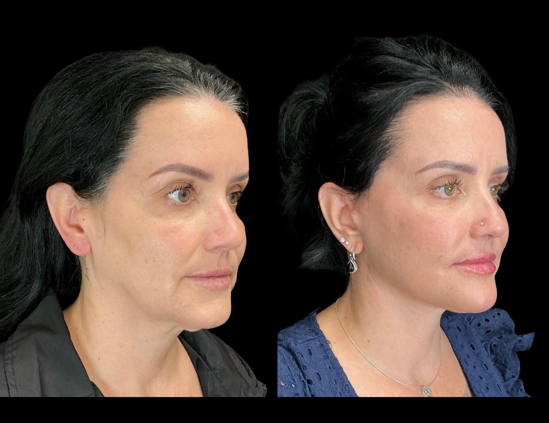 Copy of Untitled Design – 2(3)