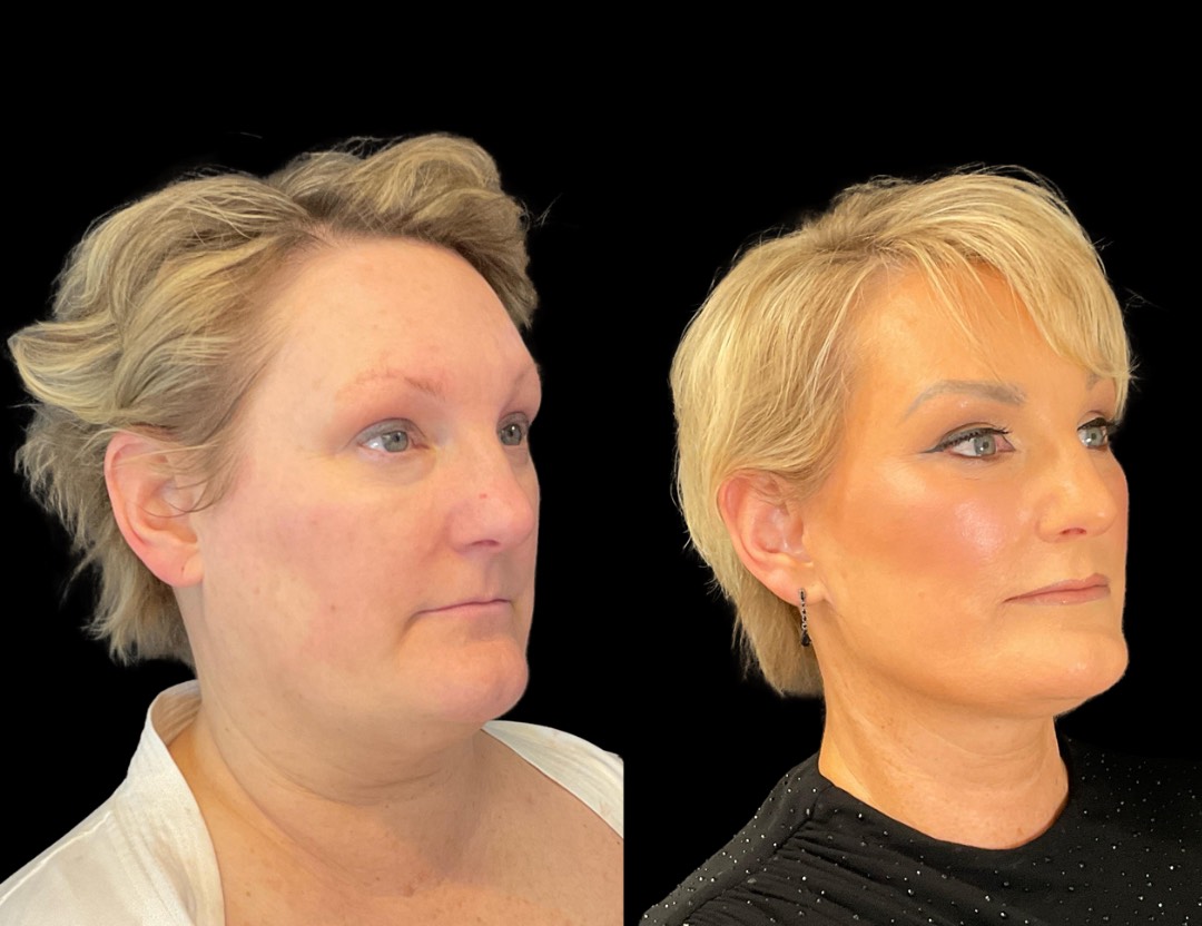 Copy of Untitled Design – 2(4)