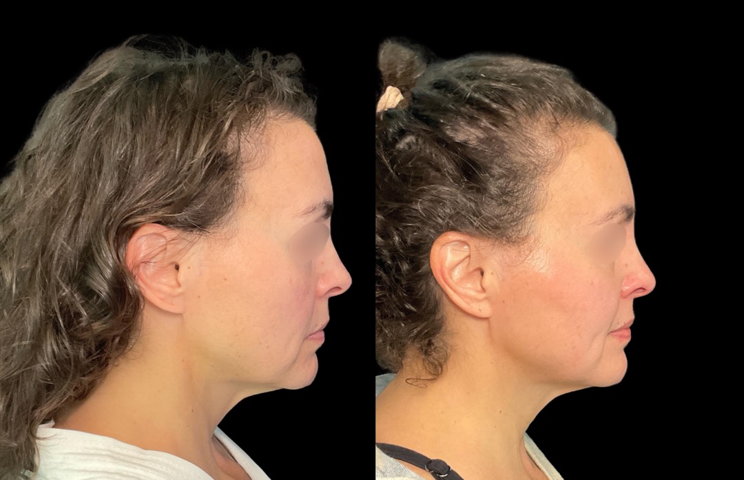 Copy of Untitled Design – 3 (2)