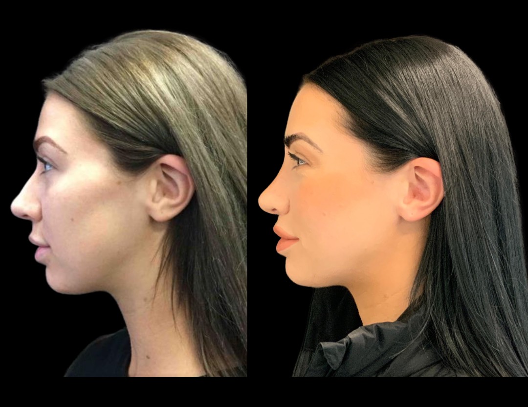 Copy of Untitled Design – 3