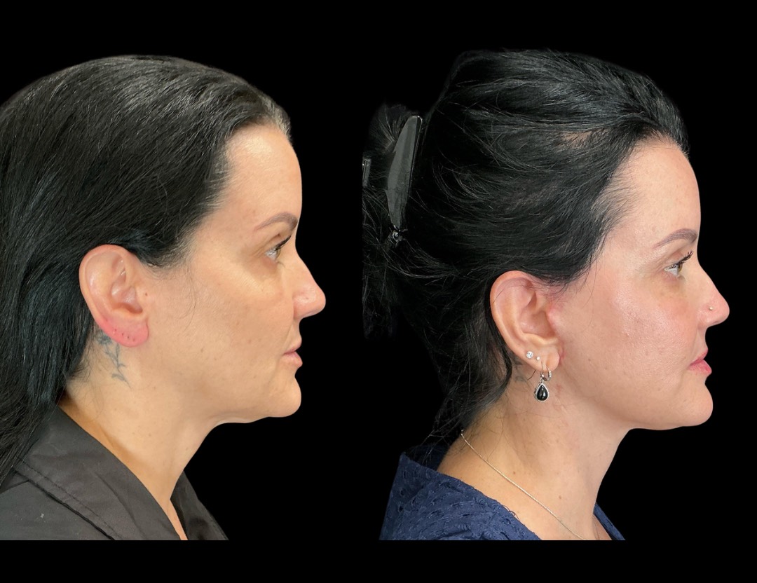 Copy of Untitled Design – 3(2)