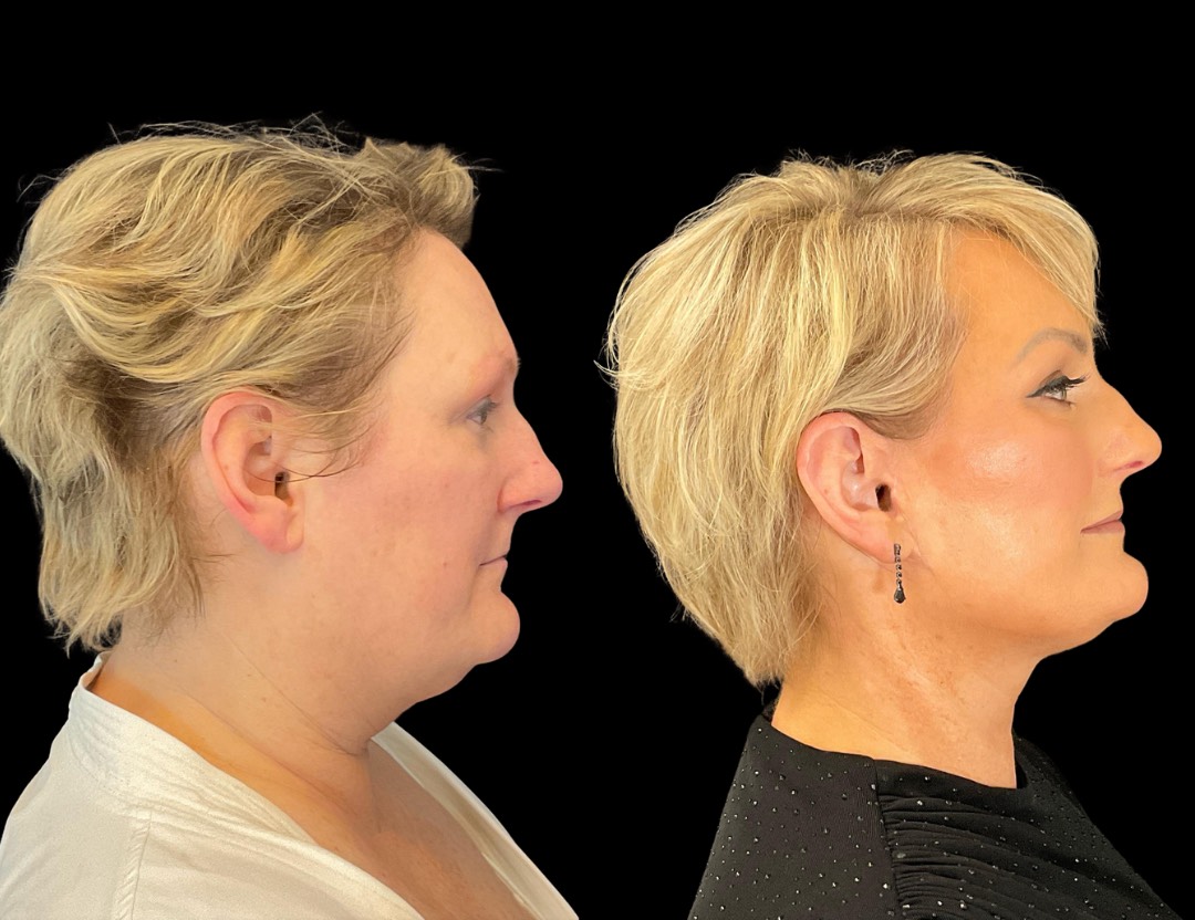 Copy of Untitled Design – 3(3)