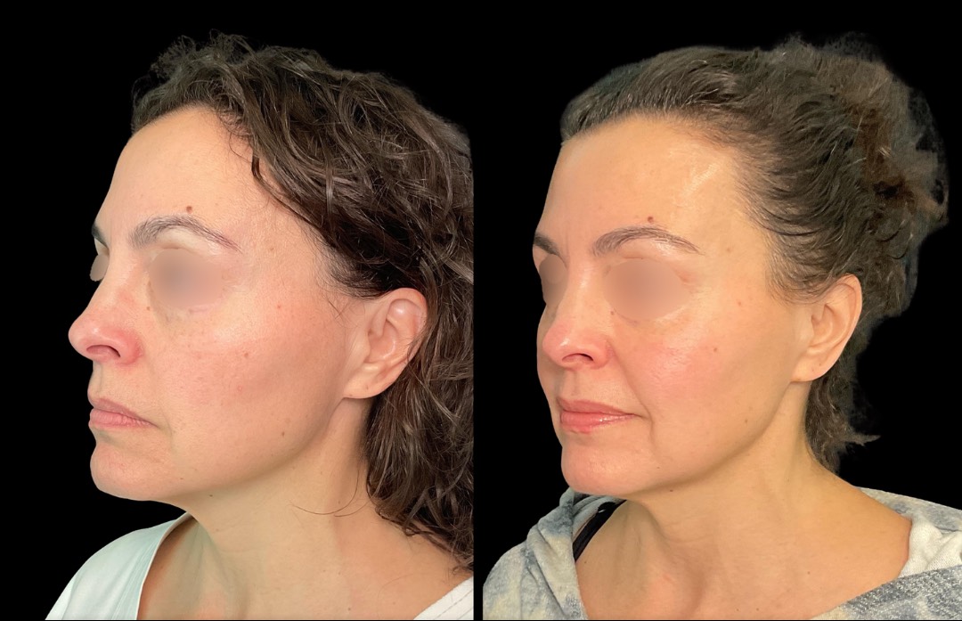 Copy of Untitled Design – 4 (1)