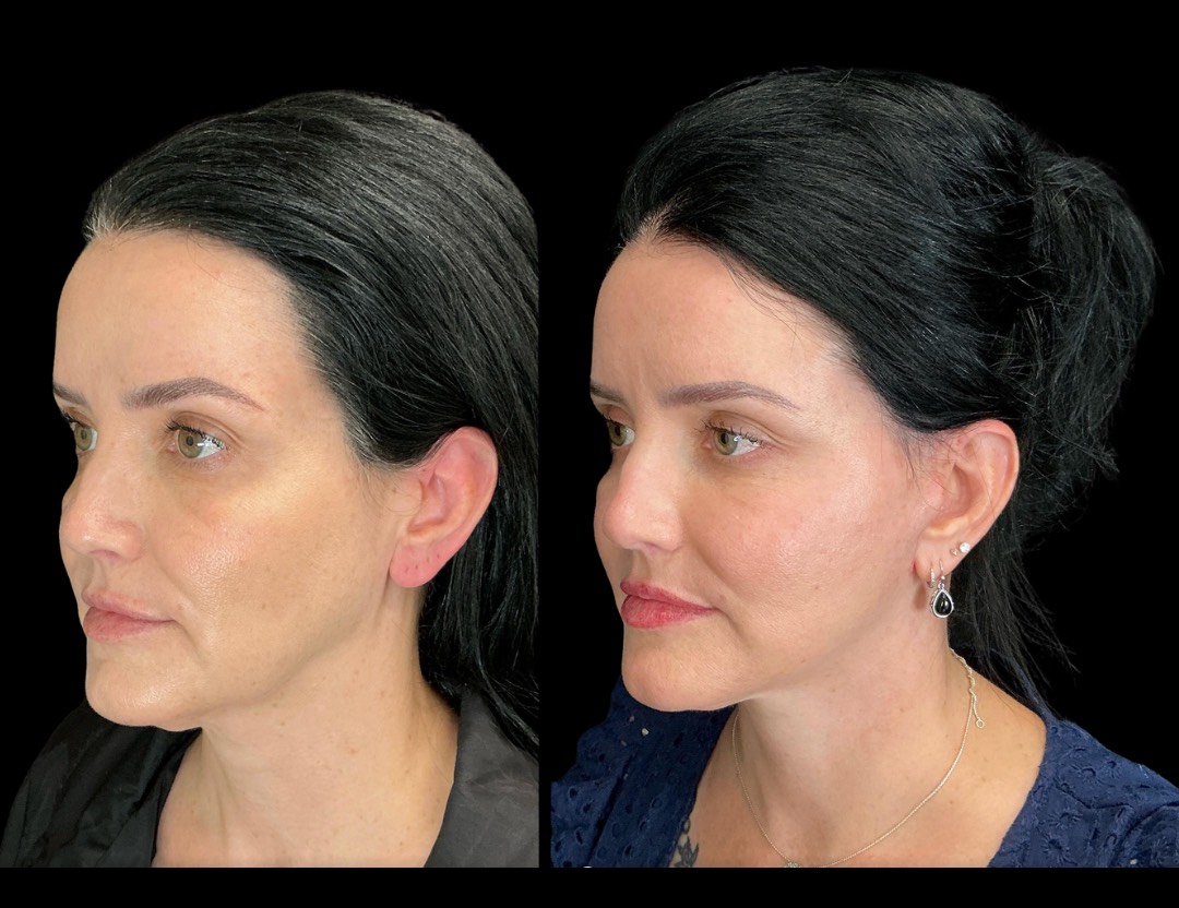 Copy of Untitled Design – 4(2)