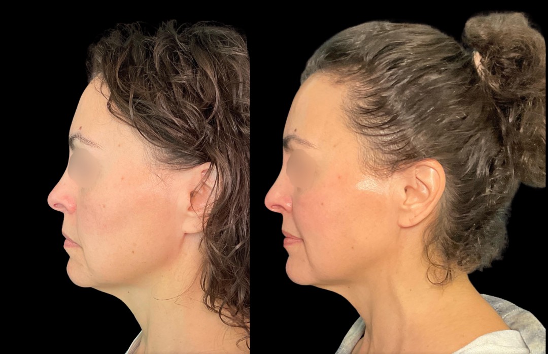 Copy of Untitled Design – 5 (1)