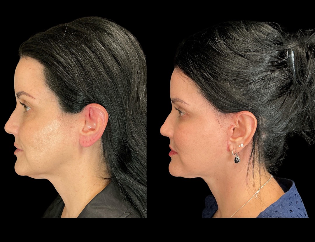 Copy of Untitled Design – 5(2)