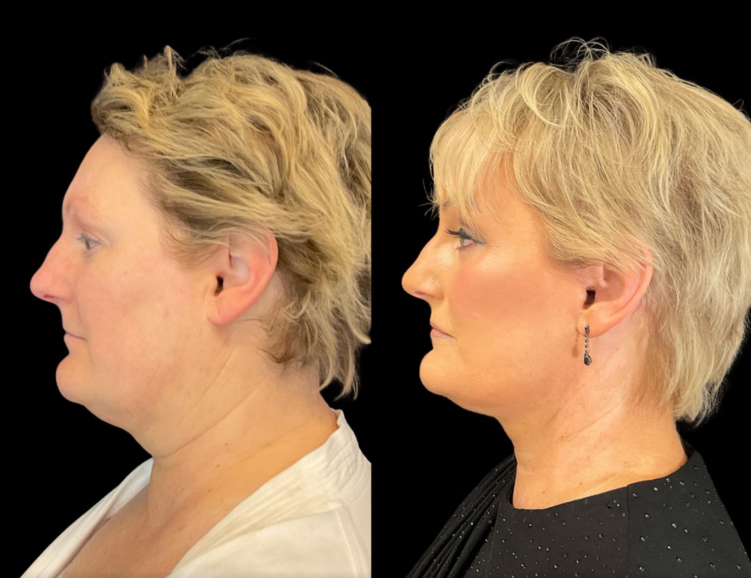 Copy of Untitled Design – 5(3)