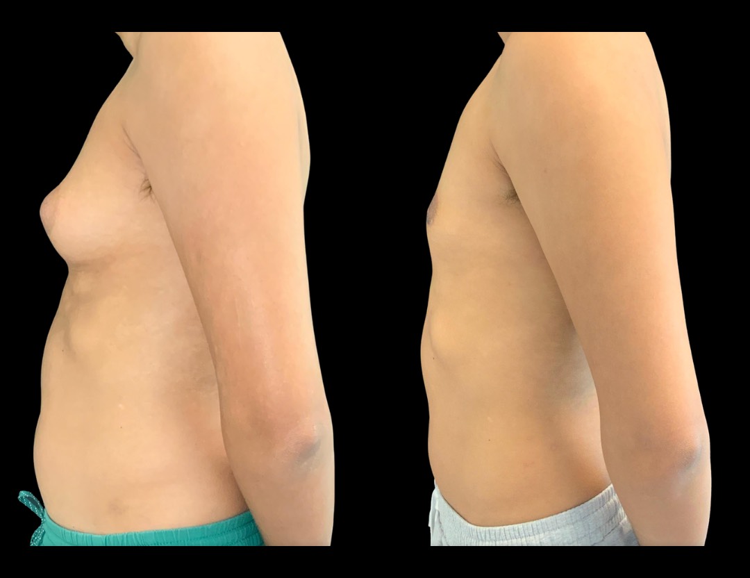 Copy of Untitled Design – 1 (1)