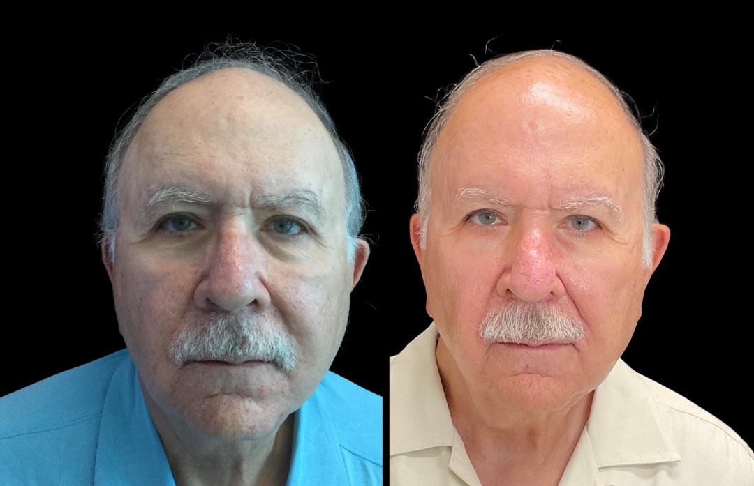 Copy of Untitled Design – 1