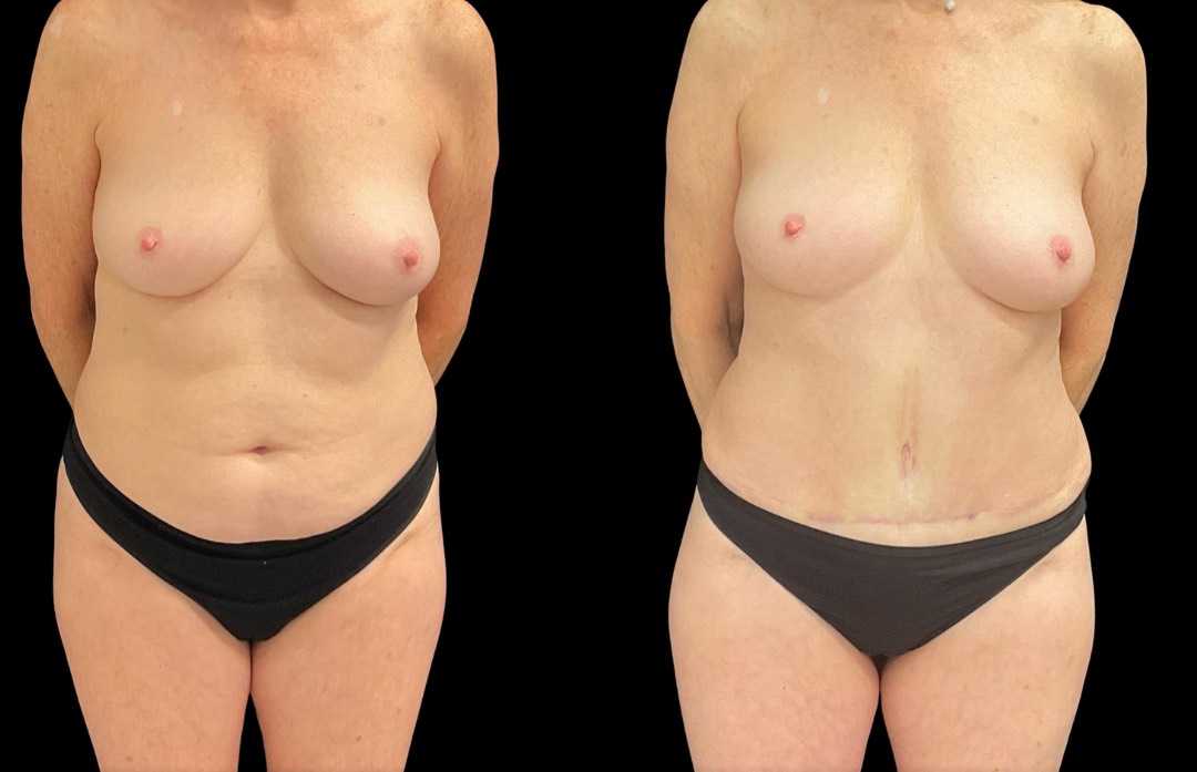 Copy of Untitled Design – 1