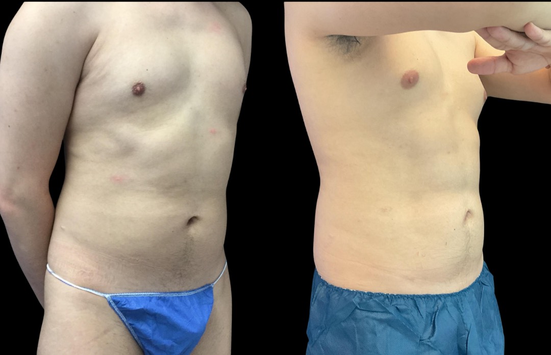 Copy of Untitled Design – 1