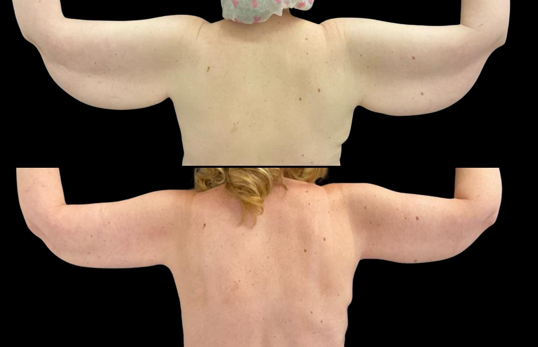 Copy of Untitled Design – 1