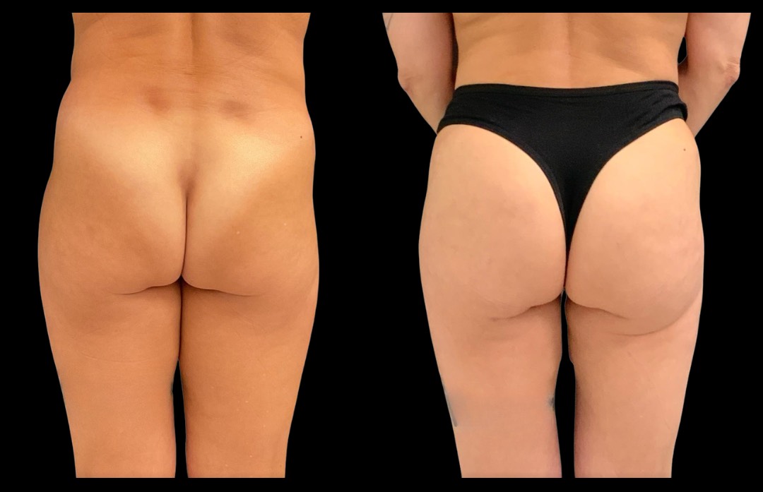 Copy of Untitled Design – 1