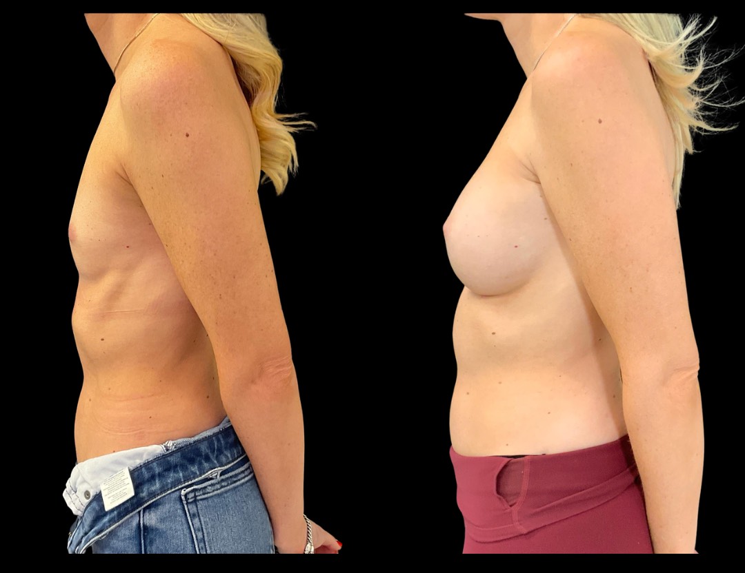 Copy of Untitled Design – 1