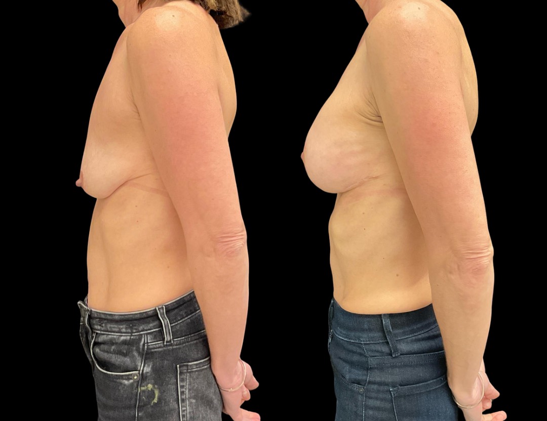 Copy of Untitled Design – 1