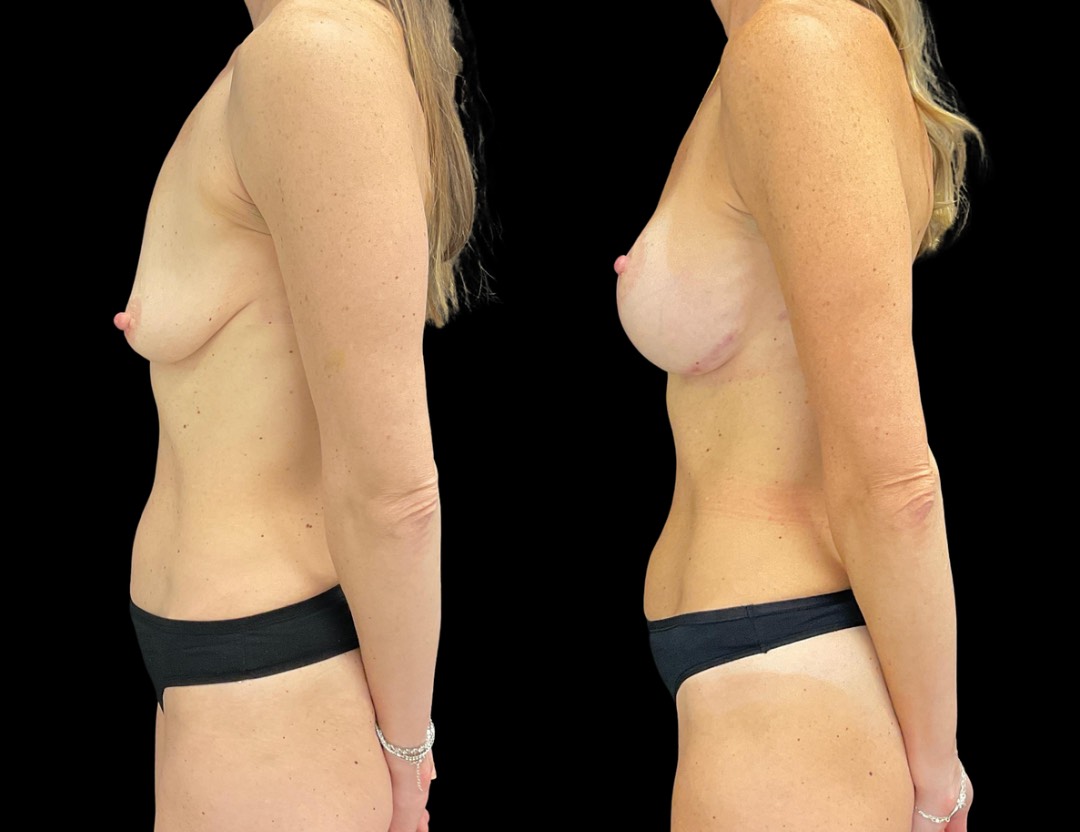 Copy of Untitled Design – 1