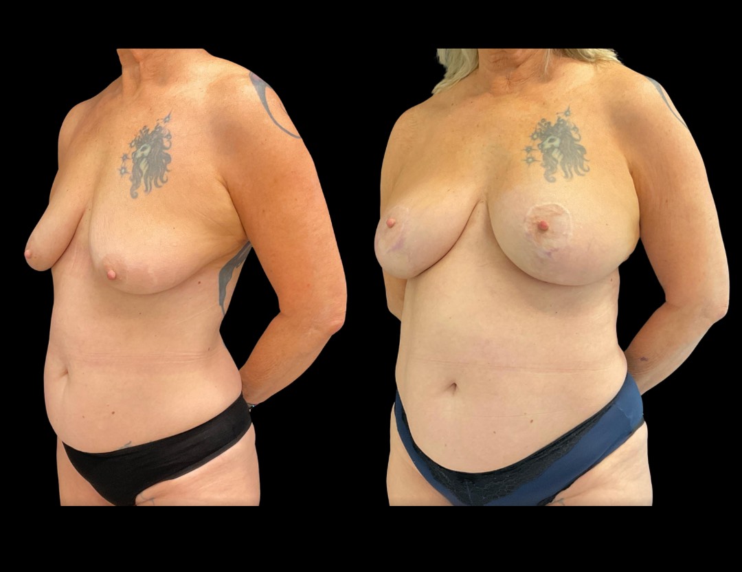 Copy of Untitled Design – 1