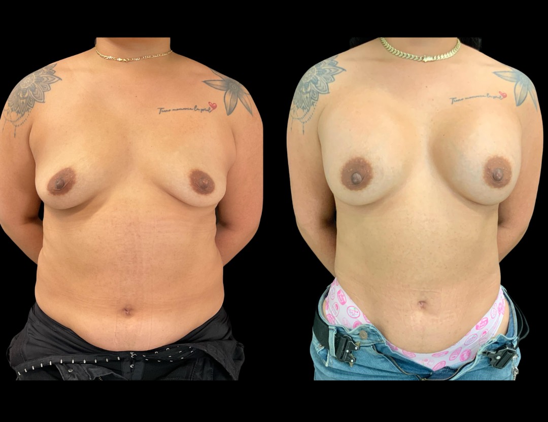 Copy of Untitled Design – 1