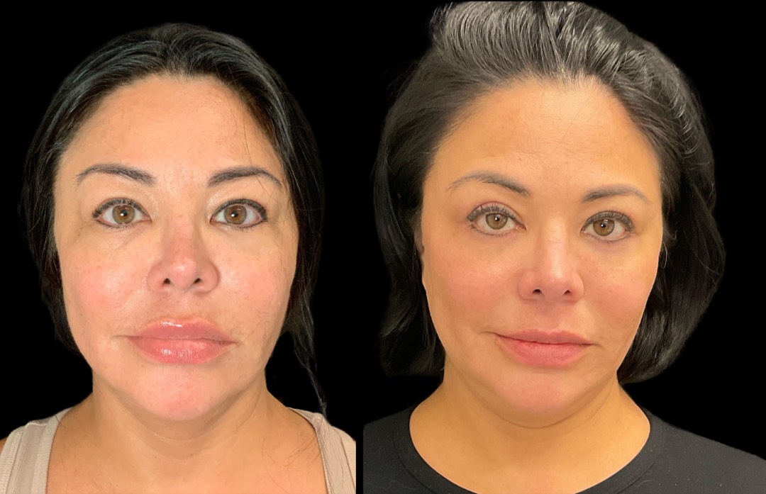 Copy of Untitled Design – 1