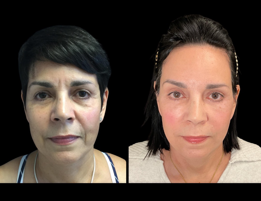 Copy of Untitled Design – 1