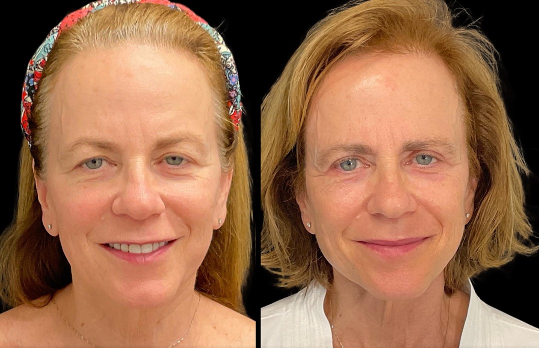 Copy of Untitled Design – 1